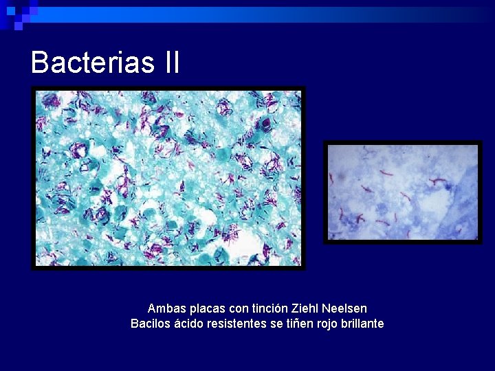Bacterias II Ambas placas con tinción Ziehl Neelsen Bacilos ácido resistentes se tiñen rojo