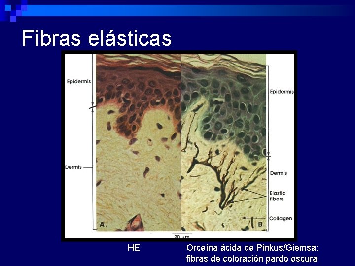 Fibras elásticas HE Orceína ácida de Pinkus/Giemsa: fibras de coloración pardo oscura 