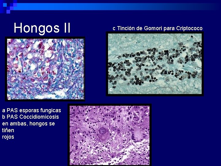 Hongos II c Tinción de Gomori para Criptococo c a a PAS esporas fungicas