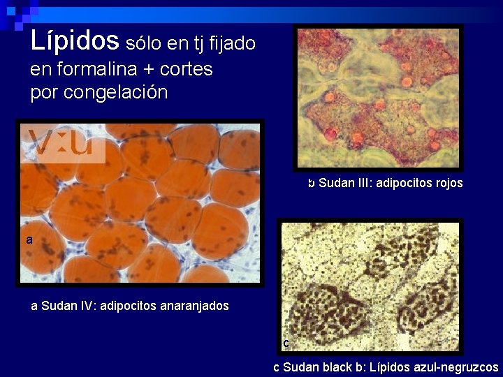 Lípidos sólo en tj fijado en formalina + cortes por congelación bb Sudan III: