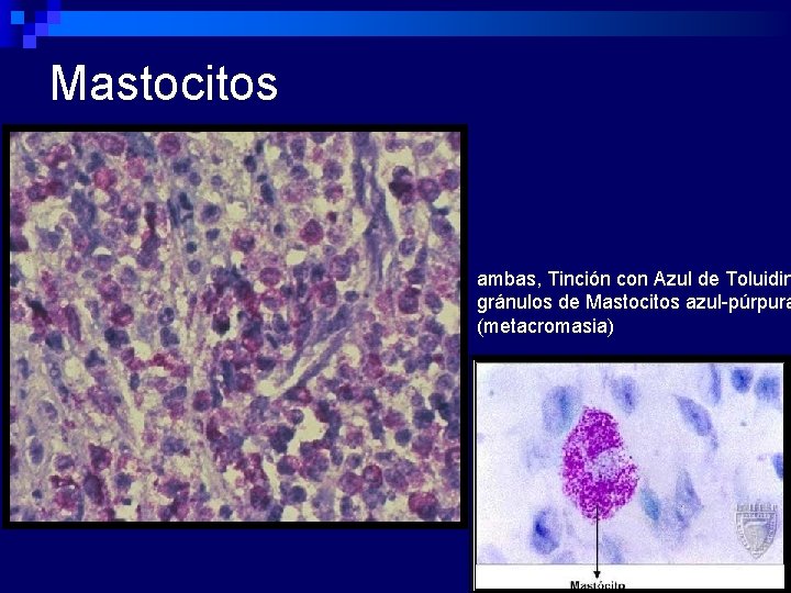 Mastocitos ambas, Tinción con Azul de Toluidin gránulos de Mastocitos azul-púrpura (metacromasia) 