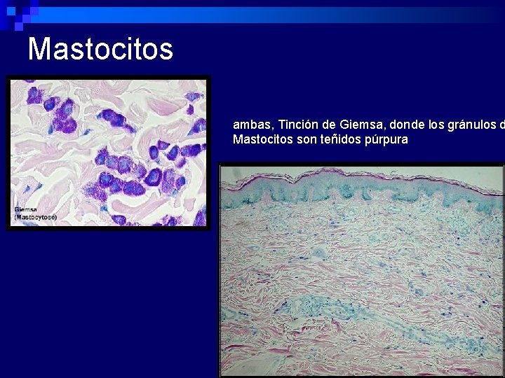 Mastocitos ambas, Tinción de Giemsa, donde los gránulos d Mastocitos son teñidos púrpura 