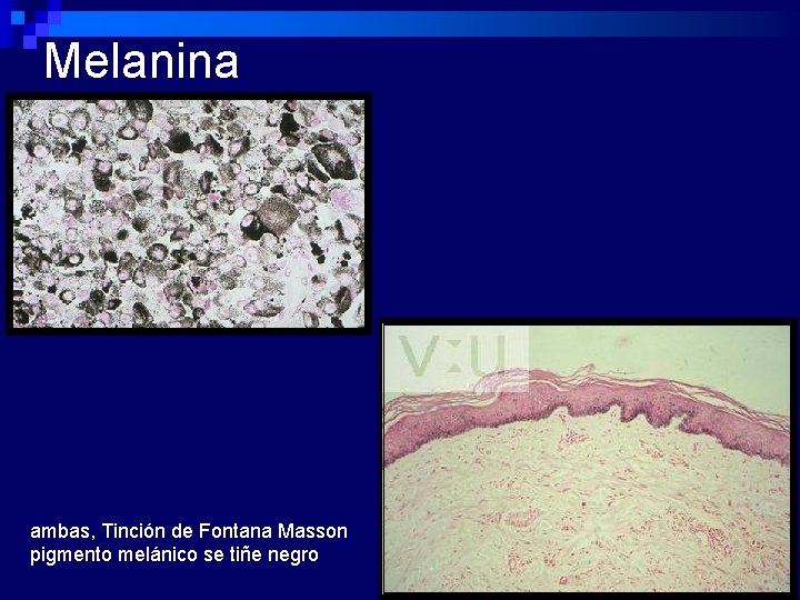Melanina ambas, Tinción de Fontana Masson pigmento melánico se tiñe negro 