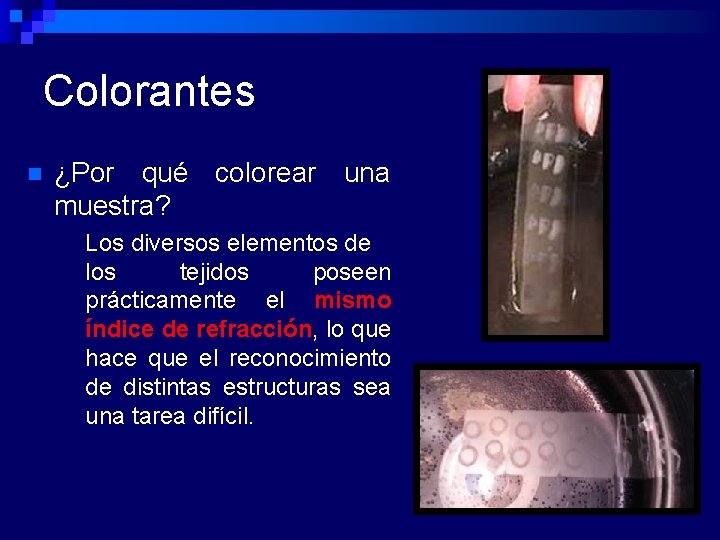 Colorantes n ¿Por qué colorear una muestra? Los diversos elementos de los tejidos poseen