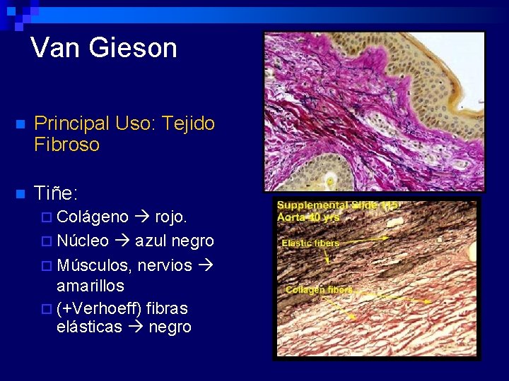 Van Gieson n Principal Uso: Tejido Fibroso n Tiñe: ¨ Colágeno rojo. ¨ Núcleo