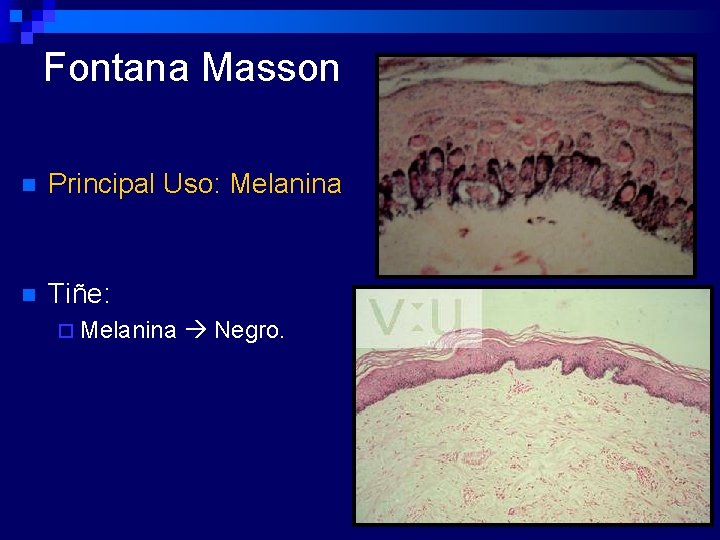 Fontana Masson n Principal Uso: Melanina n Tiñe: ¨ Melanina Negro. 