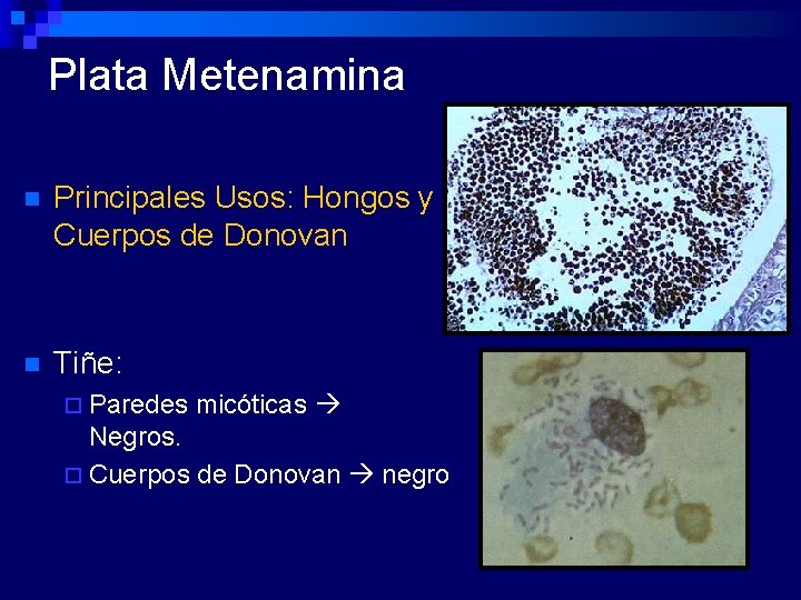 Plata Metenamina n Principales Usos: Hongos y Cuerpos de Donovan n Tiñe: ¨ Paredes