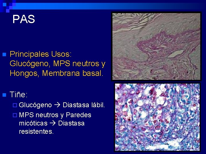 PAS n Principales Usos: Glucógeno, MPS neutros y Hongos, Membrana basal. n Tiñe: ¨