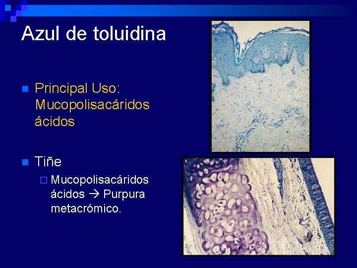 Azul de toluidina n Principal Uso: Mucopolisacáridos ácidos n Tiñe ¨ Mucopolisacáridos ácidos Purpura