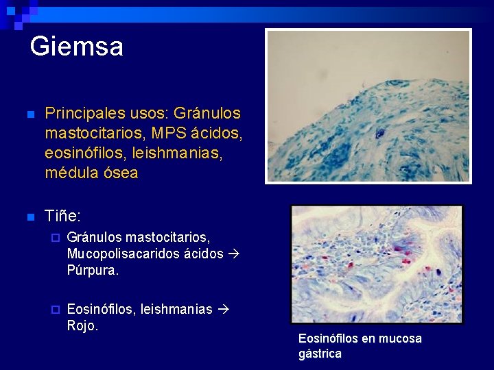 Giemsa n Principales usos: Gránulos mastocitarios, MPS ácidos, eosinófilos, leishmanias, médula ósea n Tiñe: