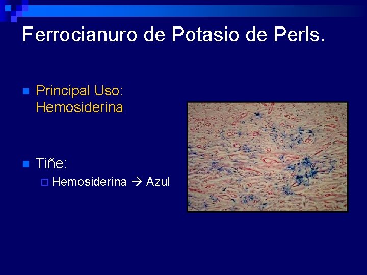 Ferrocianuro de Potasio de Perls. n Principal Uso: Hemosiderina n Tiñe: ¨ Hemosiderina Azul