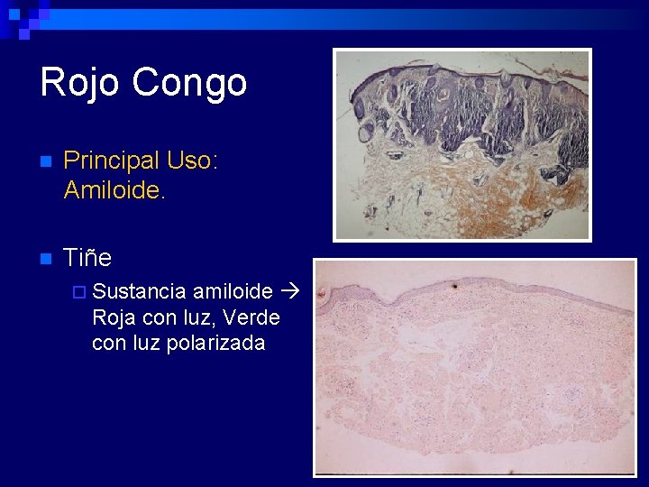 Rojo Congo n Principal Uso: Amiloide. n Tiñe ¨ Sustancia amiloide Roja con luz,