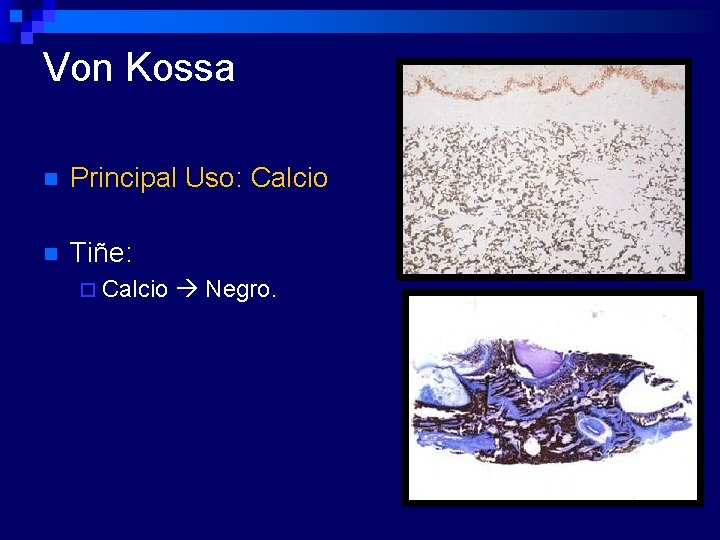 Von Kossa n Principal Uso: Calcio n Tiñe: ¨ Calcio Negro. 