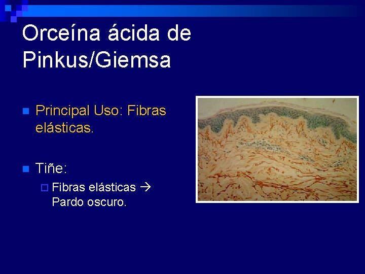 Orceína ácida de Pinkus/Giemsa n Principal Uso: Fibras elásticas. n Tiñe: ¨ Fibras elásticas
