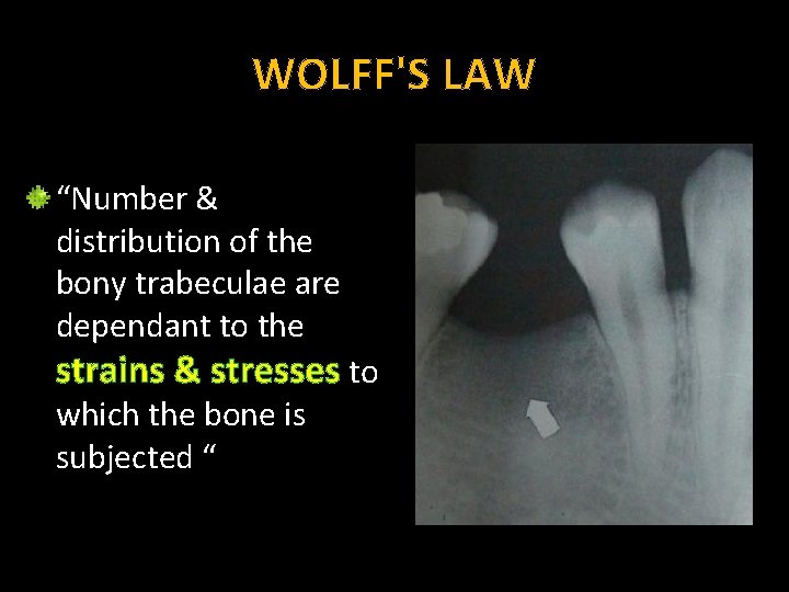 WOLFF'S LAW “Number & distribution of the bony trabeculae are dependant to the strains