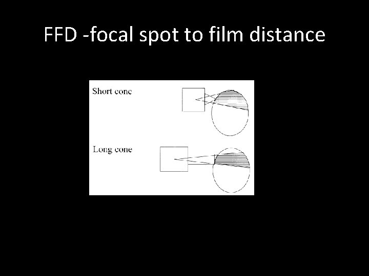 FFD -focal spot to film distance 