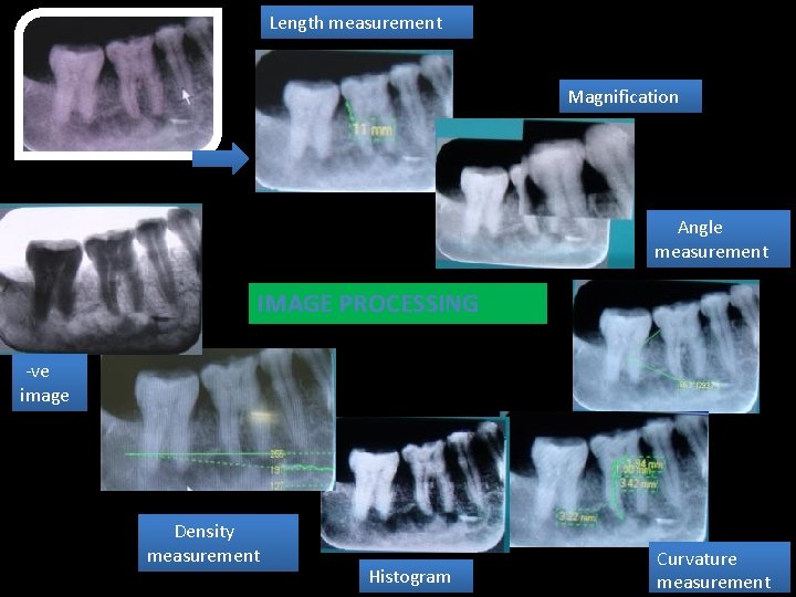 Length measurement Magnification Angle measurement IMAGE PROCESSING -ve image Density measurement Histogram Curvature measurement