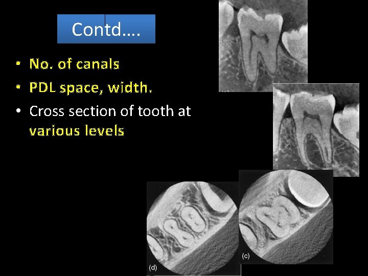 Contd…. • No. of canals • PDL space, width. • Cross section of tooth