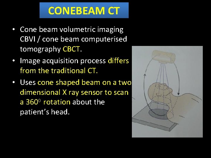 CONEBEAM CT • Cone beam volumetric imaging CBVI / cone beam computerised tomography CBCT.