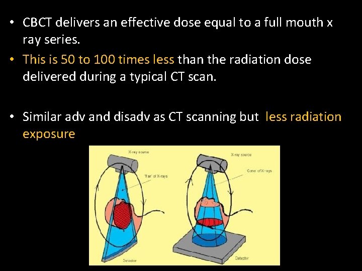  • CBCT delivers an effective dose equal to a full mouth x ray