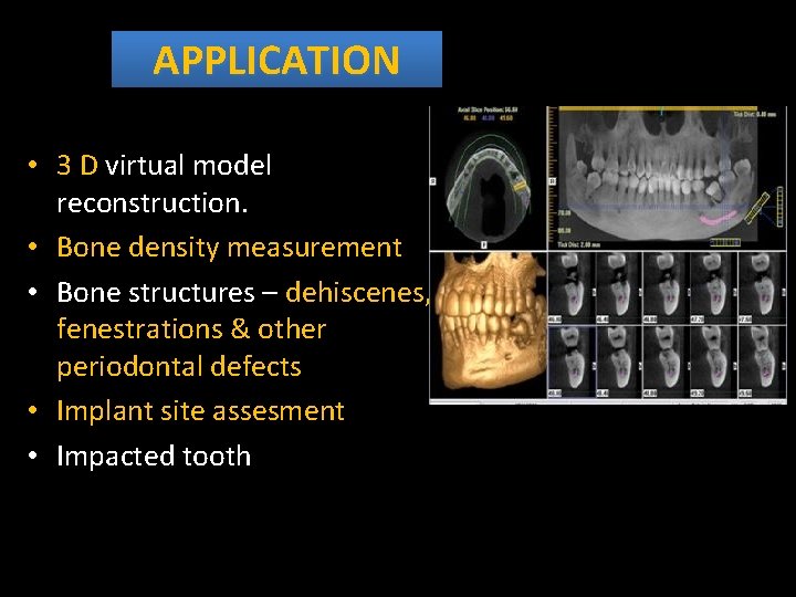 APPLICATION • 3 D virtual model reconstruction. • Bone density measurement • Bone structures