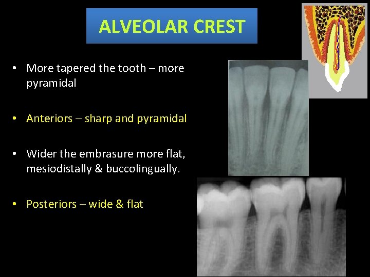 ALVEOLAR CREST • More tapered the tooth – more pyramidal • Anteriors – sharp