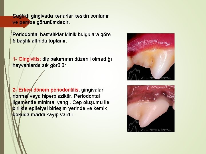 Sağlıklı gingivada kenarlar keskin sonlanır ve pembe görünümdedir. Periodontal hastalıklar klinik bulgulara göre 5 Sağlıklı gingivada kenarlar keskin sonlanır ve pembe görünümdedir. Periodontal hastalıklar klinik bulgulara göre 5