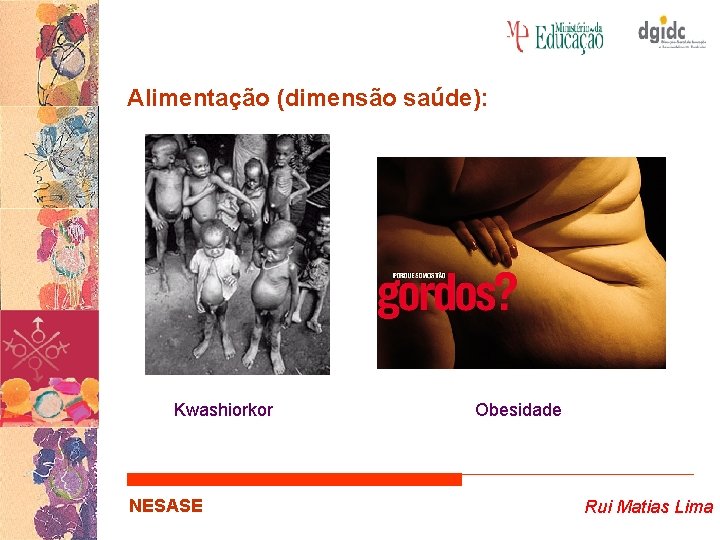 Alimentação (dimensão saúde): Kwashiorkor NESASE Obesidade Rui Matias Lima 