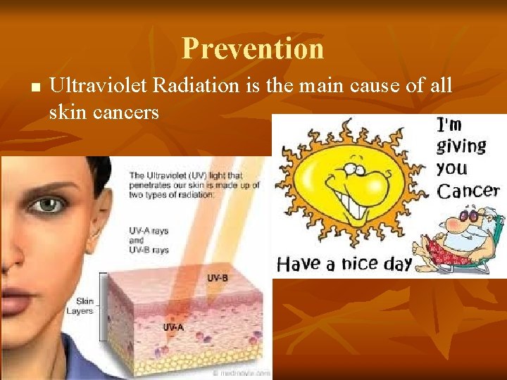 Prevention n Ultraviolet Radiation is the main cause of all skin cancers Prevention n Ultraviolet Radiation is the main cause of all skin cancers