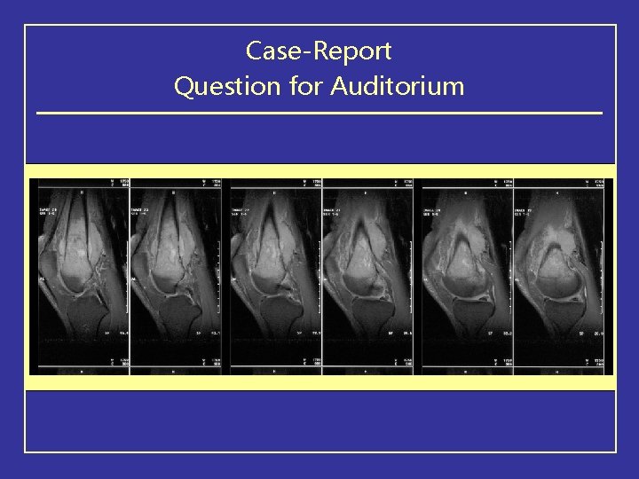 Case-Report Question for Auditorium 
