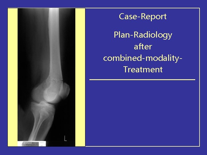Case-Report Plan-Radiology after combined-modality. Treatment 