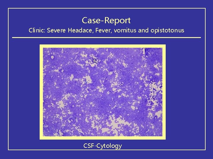 Case-Report Clinic: Severe Headace, Fever, vomitus and opistotonus CSF-Cytology 