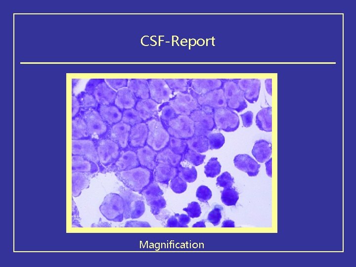 CSF-Report Magnification 