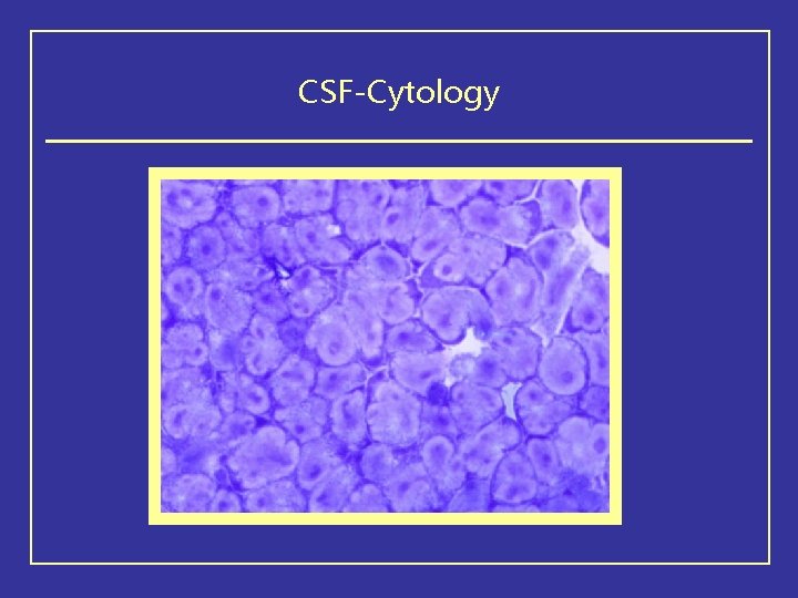CSF-Cytology 