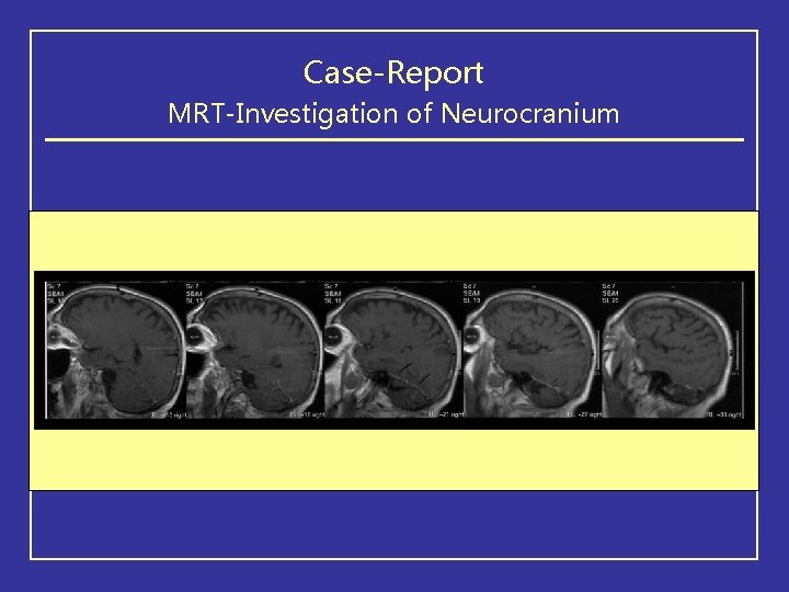 Case-Report MRT-Investigation of Neurocranium 