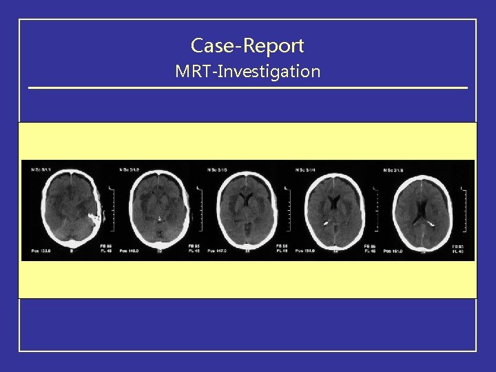 Case-Report MRT-Investigation 