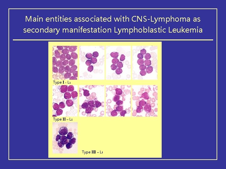 Main entities associated with CNS-Lymphoma as secondary manifestation Lymphoblastic Leukemia Type I - L