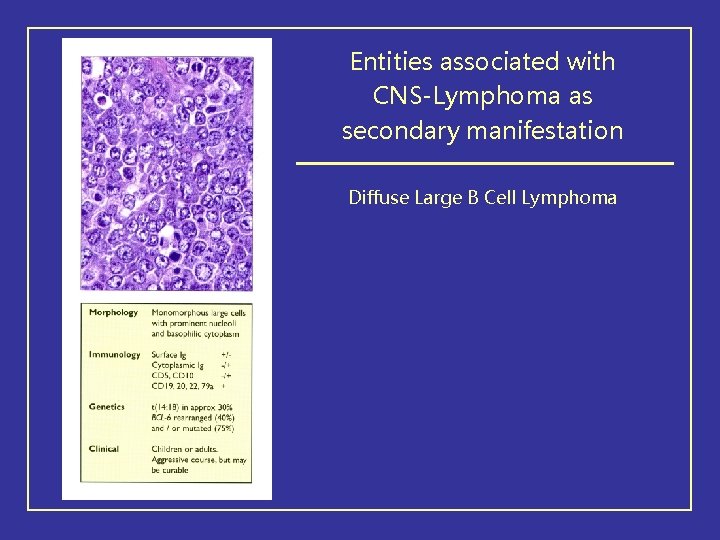 Entities associated with CNS-Lymphoma as secondary manifestation Diffuse Large B Cell Lymphoma 