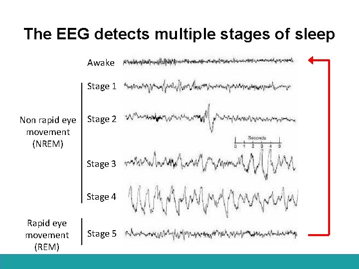 The EEG detects multiple stages of sleep Awake Stage 1 Non rapid eye movement