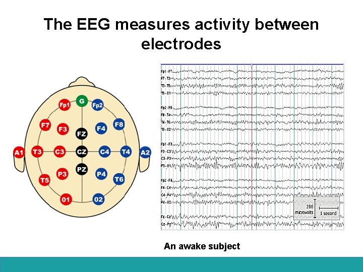 The EEG measures activity between electrodes An awake subject 