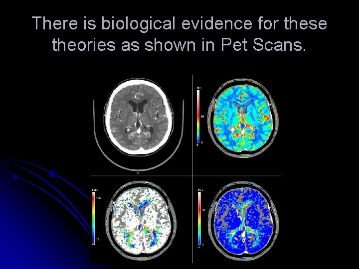 There is biological evidence for these theories as shown in Pet Scans. 