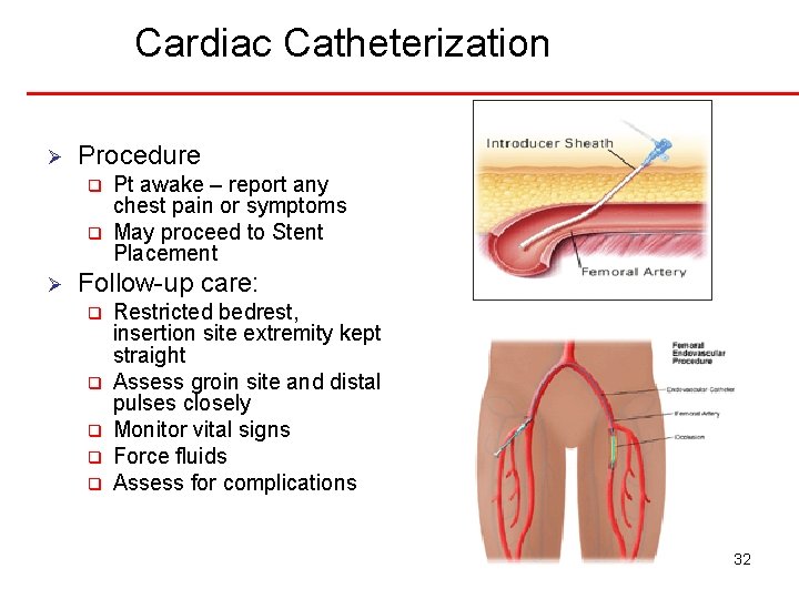 Cardiac Catheterization Ø Procedure q q Ø Pt awake – report any chest pain