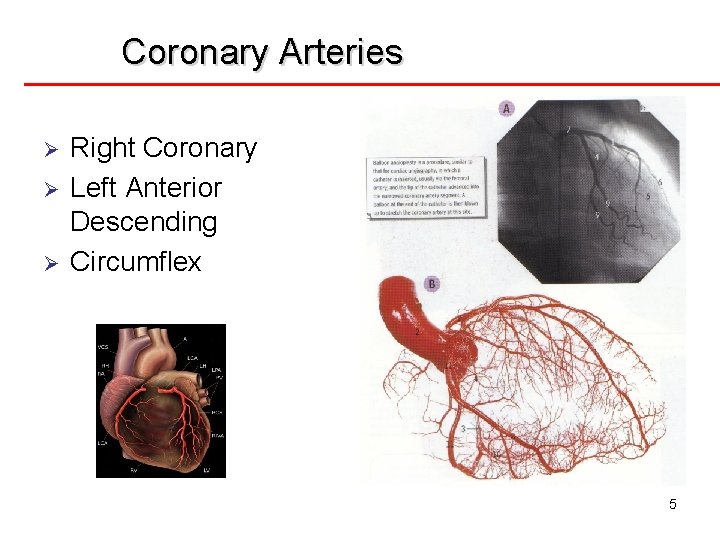 Coronary Arteries Ø Ø Ø Right Coronary Left Anterior Descending Circumflex 5 