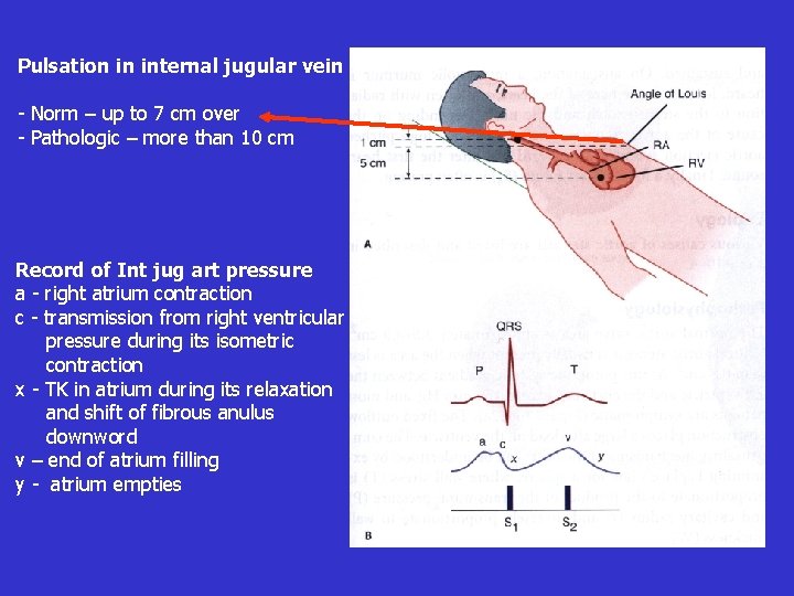 Pulsation in internal jugular vein - Norm – up to 7 cm over -