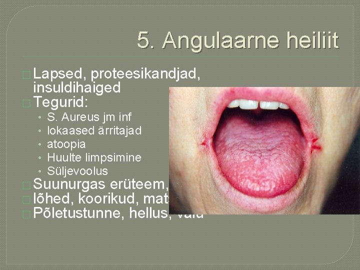 5. Angulaarne heiliit � Lapsed, proteesikandjad, insuldihaiged � Tegurid: • • • S. Aureus