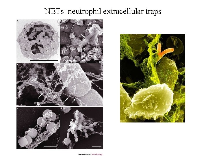 NETs: neutrophil extracellular traps 