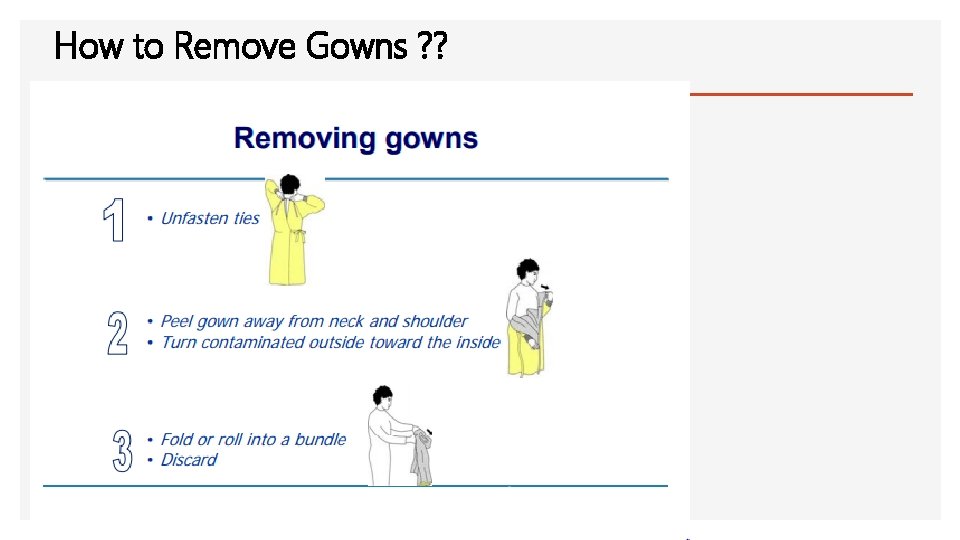 How to Remove Gowns ? ? 