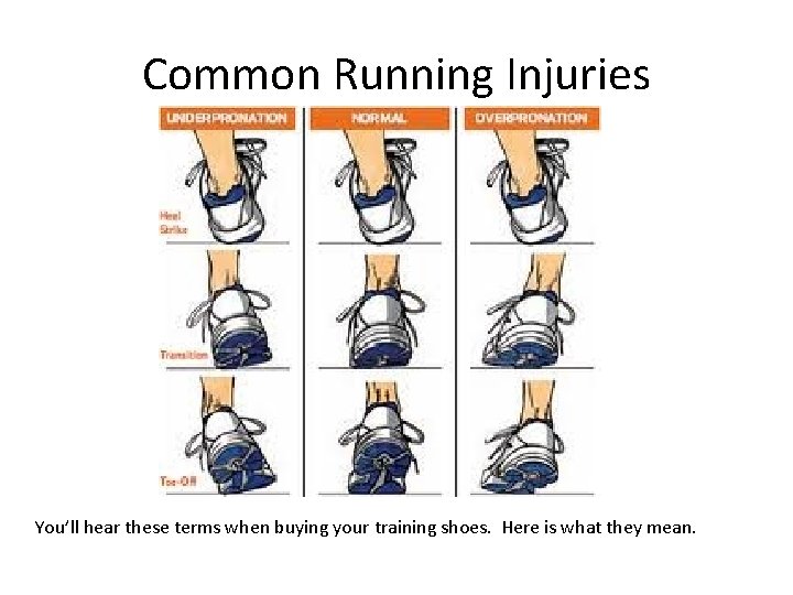 Common Running Injuries You’ll hear these terms when buying your training shoes. Here is Common Running Injuries You’ll hear these terms when buying your training shoes. Here is