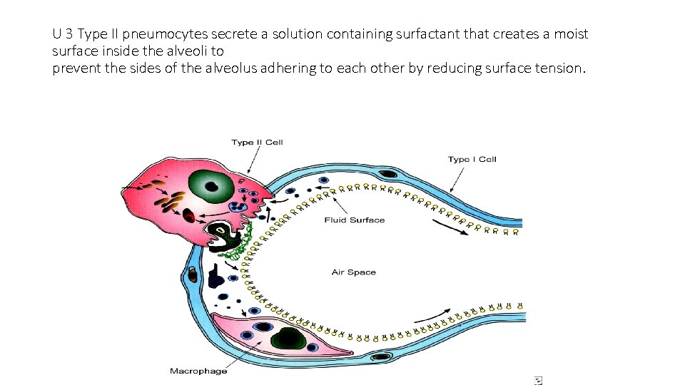 U 3 Type II pneumocytes secrete a solution containing surfactant that creates a moist