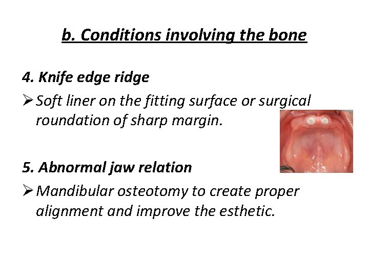 b. Conditions involving the bone 4. Knife edge ridge Ø Soft liner on the